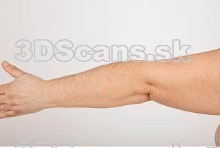 Photo reference of forearm 0001